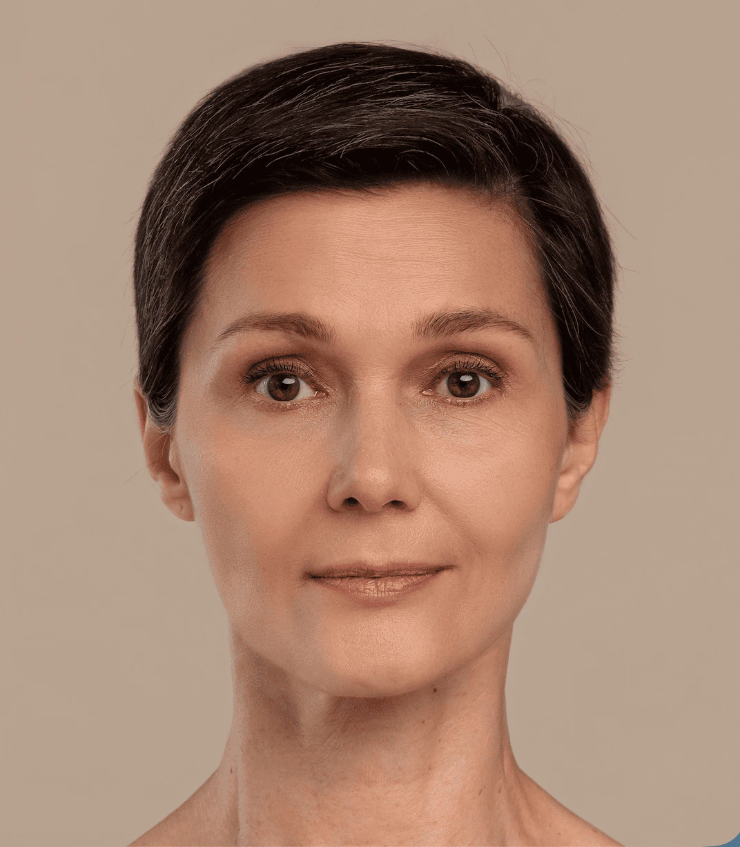 Facelift After