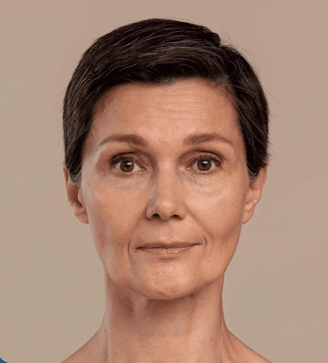 Facelift Before