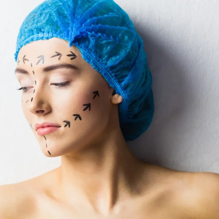 Facelift Surgery Explained.jpg